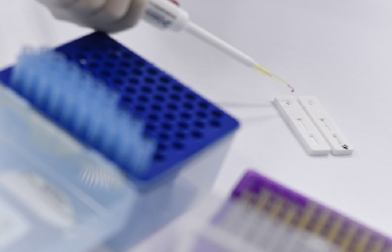 O paciente tinha 44 anos e, aparentemente, contraiu a doença via transmissão comunitária.