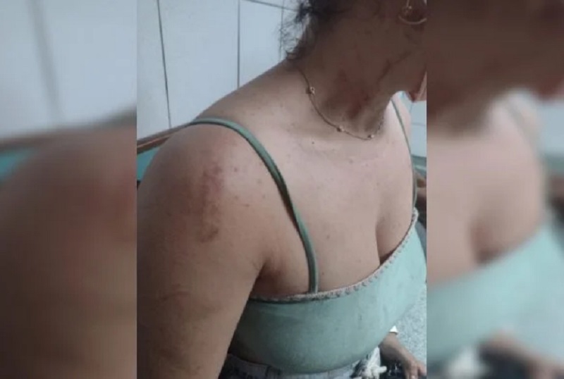 Mulher é espancada por companheiro