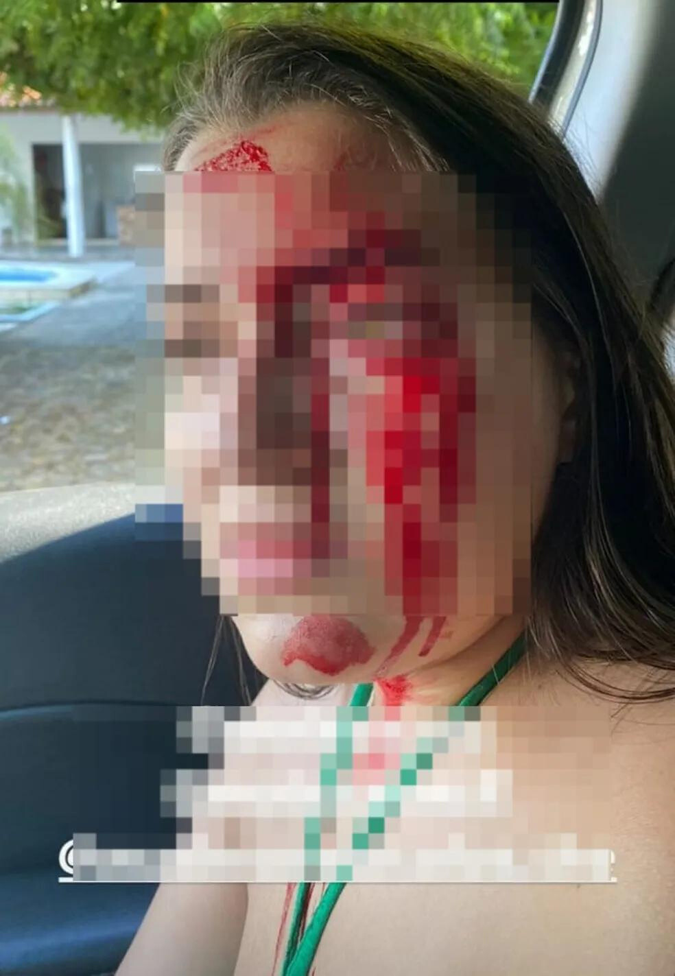 Victória Aparecida Soares Batista, 23 anos, usa sua rede social para denunciar agressão sofrida