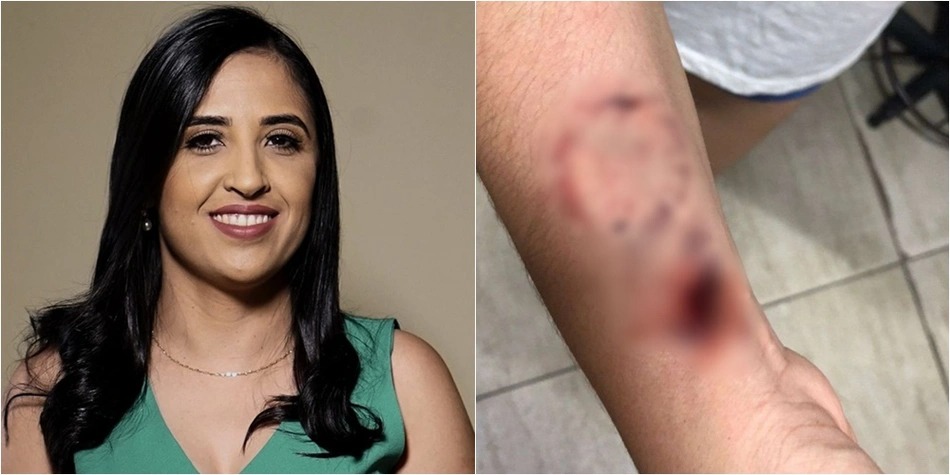 Prefeita Dra. Kaylanne foi acusada de ferir enfermeira com mordidas