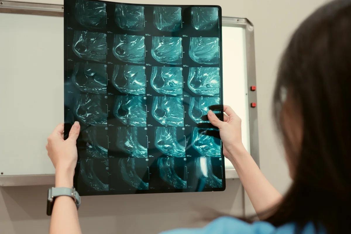 O câncer de mama ainda é o tipo que mais mata mulheres no Brasil e pode ser detectado com um simples exame, de forma precoce, o que aumenta chances de cura